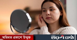 ঘরোয়া উপায়ে ব্রণ দূর করবেন যেভাবে